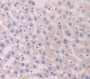 Antithrombin (At) Polyclonal Antibody, Cat#CAU24413