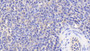 DAB staining on IHC-P; Samples: Human Spleen Tissue; Primary Ab: 20μg/ml Rabbit Anti-Human AT Antibody Second Ab: 2µg/mL HRP-Linked Caprine Anti-Rabbit IgG Polyclonal Antibody