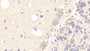 DAB staining on IHC-P; Samples: Human Cerebellum Tissue; Primary Ab: 20μg/ml Rabbit Anti-Human TUBa3C Antibody Second Ab: 2µg/mL HRP-Linked Caprine Anti-Rabbit IgG Polyclonal Antibody