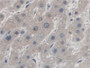 DAB staining on IHC-P; Samples: Human Liver Tissue; Primary Ab: 10µg/ml Rabbit Anti-Human AZIN1 Antibody Second Ab: 2µg/mL HRP-Linked Caprine Anti-Rabbit IgG Polyclonal Antibody