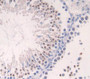 Used in DAB staining on fromalin fixed paraffin- embedded Kidney tissue