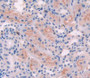 Used in DAB staining on fromalin fixed paraffin- embedded Kidney tissue