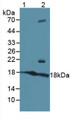 Western Blot; Sample: Lane1: Human Serum; Lane2: Human 293T Cells.