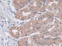 DAB staining on IHC-P; Samples: Human Stomach Tissue; Primary Ab: 10µg/ml Rabbit Anti-Human ASAH1 Antibody Second Ab: 2µg/mL HRP-Linked Caprine Anti-Rabbit IgG Polyclonal Antibody