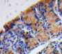 Used in DAB staining on fromalin fixed paraffin-embedded Bowels tissue