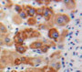 Used in DAB staining on fromalin fixed paraffin-embedded Liver tissue