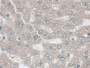 DAB staining on IHC-P; Samples: Rat Liver Tissue; Primary Ab: 20µg/ml Rabbit Anti-Rat AK2 Antibody Second Ab: 2µg/mL HRP-Linked Caprine Anti-Rabbit IgG Polyclonal Antibody