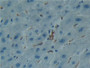 DAB staining on IHC-P; Samples: Human Liver Tissue.