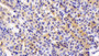 DAB staining on IHC-P; Samples: Rat Stomach Tissue;  Primary Ab: 10μg/ml Rabbit Anti-Rat AGR2 Antibody Second Ab: 2µg/mL HRP-Linked Caprine Anti-Rabbit IgG Polyclonal Antibody 