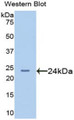 Western Blot; Sample: Recombinant protein.