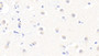 DAB staining on IHC-P. Samples: Human Tissue)