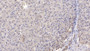 DAB staining on IHC-P; Samples: Human Liver Tissue; Primary Ab: 20µg/ml Rabbit Anti-Human ADK Antibody Second Ab: 2µg/mL HRP-Linked Caprine Anti-Rabbit IgG Polyclonal Antibody