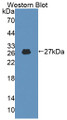 Western Blot; Sample: Recombinant protein.