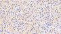 DAB staining on IHC-P; Samples: Human Liver Tissue; Primary Ab: 20μg/ml Rabbit Anti-Human ACY1 Antibody Second Ab: 2µg/mL HRP-Linked Caprine Anti-Rabbit IgG Polyclonal Antibody