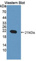 Western Blot; Sample: Recombinant protein.