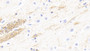 DAB staining on IHC-P; Samples: Human Cerebrum Tissue; Primary Ab: 20μg/ml Rabbit Anti-Human CNP Antibody Second Ab: 2µg/mL HRP-Linked Caprine Anti-Rabbit IgG Polyclonal Antibody