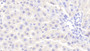 DAB staining on IHC-P; Samples: Rat Liver Tissue;  Primary Ab: 20μg/ml Rabbit Anti-Rat SHP Antibody Second Ab: 2µg/mL HRP-Linked Caprine Anti-Rabbit IgG Polyclonal Antibody 