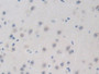 DAB staining on IHC-P; Samples: Mouse Brain Tissue; Primary Ab: 10µg/ml Rabbit Anti-Mouse BRD8 Antibody Second Ab: 2µg/mL HRP-Linked Caprine Anti-Rabbit IgG Polyclonal Antibody