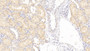 DAB staining on IHC-P; Samples: Human Kidney Tissue; Primary Ab: 20μg/ml Rabbit Anti-Human DNASEII Antibody Second Ab: 2µg/mL HRP-Linked Caprine Anti-Rabbit IgG Polyclonal Antibody