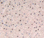 Used in DAB staining on fromalin fixed paraffin- embedded liver tissue