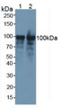 Western Blot; Sample: Lane1: Mouse Brain Tissue; Lane2: Mouse Spleen Tissue.