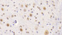 DAB staining on IHC-P; Samples: Mouse Cerebellum Tissue; Primary Ab: 20μg/ml Rabbit Anti-Mouse NCL Antibody Second Ab: 2µg/mL HRP-Linked Caprine Anti-Rabbit IgG Polyclonal Antibody
