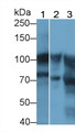 Western Blot; Sample: Lane1: Porcine Spleen lysate; Lane2: Porcine Skeletal muscle lysate; Lane3: Raji cell lysate; Primary Ab: 1μg/ml Rabbit Anti-Human ACTN1 Antibody; Second Ab: 0.2µg/mL HRP-Linked Caprine Anti-Rabbit IgG Polyclonal Antibody;