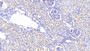 DAB staining on IHC-P; Samples: Human Kidney Tissue;  Primary Ab: 20μg/ml Rabbit Anti-Human ACTN1 Antibody Second Ab: 2µg/mL HRP-Linked Caprine Anti-Rabbit IgG Polyclonal Antibody 