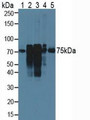 Western Blot; Sample: Lane1: Rat Serum; Lane2: Rat Lung Tissue; Lane3: Rat Placenta Tissue; Lane4: Rat Uterus Tissue; Lane5: Human Hela Cells.