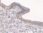 DAB staining on IHC-P; Samples: Mouse Uterus Tissue; Primary Ab: 30µg/ml Rabbit Anti-Mouse CTTN Antibody Second Ab: 2µg/mL HRP-Linked Caprine Anti-Rabbit IgG Polyclonal Antibody