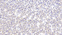 DAB staining on IHC-P; Samples: Mouse Kidney Tissue;  Primary Ab: 20μg/ml Rabbit Anti-Mouse PFN1 Antibody Second Ab: 2µg/mL HRP-Linked Caprine Anti-Rabbit IgG Polyclonal Antibody 