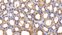 DAB staining on IHC-P; Samples: Human Kidney Tissue; Primary Ab: 30ug/ml Rabbit Anti-Human PKBa Antibody Second Ab: 2µg/mL HRP-Linked Caprine Anti-Rabbit IgG Polyclonal Antibody
