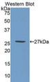 Western Blot; Sample: Recombinant protein.