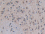 DAB staining on IHC-P; Samples: Mouse Brain Tissue;  Primary Ab: 10µg/ml Rabbit Anti-Mouse EP300 Ant