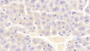 DAB staining on IHC-P; Samples: Mouse Liver Tissue; Primary Ab: 20μg/ml Rabbit Anti-Mouse VAV1 Antibody Second Ab: 2µg/mL HRP-Linked Caprine Anti-Rabbit IgG Polyclonal Antibody