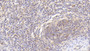 DAB staining on IHC-P; Samples: Human Spleen Tissue; Primary Ab: 20μg/ml Rabbit Anti-Human VAV1 Antibody Second Ab: 2µg/mL HRP-Linked Caprine Anti-Rabbit IgG Polyclonal Antibody