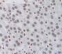 Used in DAB staining on fromalin fixed paraffin- embedded liver tissue