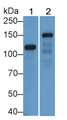 Western Blot; Sample: Lane1: Porcine Kidney lysate; Lane2: 293T cell lysate; Primary Ab: 4μg/ml Rabbit Anti-Human DSG2 Antibody; Second Ab: 0.2µg/mL HRP-Linked Caprine Anti-Rabbit IgG Polyclonal Antibody;