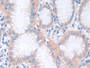 DAB staining on IHC-P; Samples: Human Stomach Tissue; Primary Ab: 10µg/ml Rabbit Anti-Human CTNNa1 Antibody Second Ab: 2µg/mL HRP-Linked Caprine Anti-Rabbit IgG Polyclonal Antibody