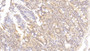 DAB staining on IHC-P; Samples: Human Small intestine Tissue;  Primary Ab: 20μg/ml Rabbit Anti-Human AXIN Antibody Second Ab: 2µg/mL HRP-Linked Caprine Anti-Rabbit IgG Polyclonal Antibody 