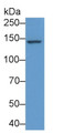 Western Blot; Sample: Mouse Liver lysate; Primary Ab: 5μg/ml Rabbit Anti-Human 28a Antibody; Second Ab: 0.2µg/mL HRP-Linked Caprine Anti-Rabbit IgG Polyclonal Antibody;