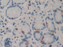 DAB staining on IHC-P; Samples: Human Stomach Tissue;  Primary Ab: 10µg/ml Rabbit Anti-Human PARN An