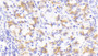 DAB staining on IHC-P; Samples: Human Stomach Tissue;  Primary Ab: 20μg/ml Rabbit Anti-Human NRG4 Antibody Second Ab: 2µg/mL HRP-Linked Caprine Anti-Rabbit IgG Polyclonal Antibody 