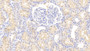 DAB staining on IHC-P; Samples: Human Kidney Tissue;  Primary Ab: 20μg/ml Rabbit Anti-Human MHCDRa Antibody Second Ab: 2µg/mL HRP-Linked Caprine Anti-Rabbit IgG Polyclonal Antibody 
