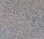 Collagen Type X (Col10) Polyclonal Antibody, Cat#CAU24602