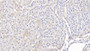 DAB staining on IHC-P; Samples: Bovine Liver Tissue;  Primary Ab: 20μg/ml Rabbit Anti-Bovine COL10 Antibody Second Ab: 2µg/mL HRP-Linked Caprine Anti-Rabbit IgG Polyclonal Antibody 