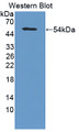 Western Blot; Sample: Recombinant protein.