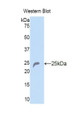 Western Blot; Sample: Recombinant protein.