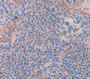 Collagen Type Vii (Col7) Polyclonal Antibody, Cat#CAU24612