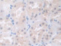 DAB staining on IHC-P; Samples: Human Kidney Tissue;  Primary Ab: 30µg/ml Rabbit Anti-Human COL4a5 A